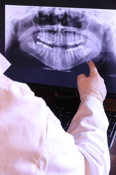 Best Emergency Wisdom Teeth Removal in Hettinger, ND