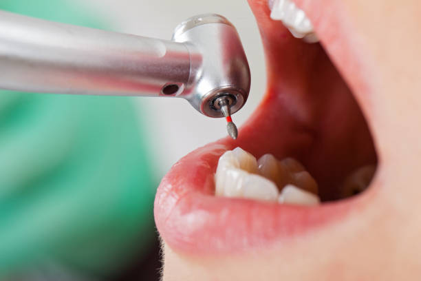 Reliable ND Emergency Dentist Solutions
